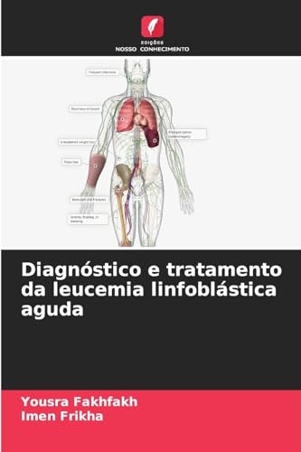Diagnóstico e tratamento da leucemia linfoblástica aguda: DE von Edições Nosso Conhecimento