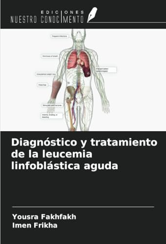 Diagnóstico y tratamiento de la leucemia linfoblástica aguda von Ediciones Nuestro Conocimiento