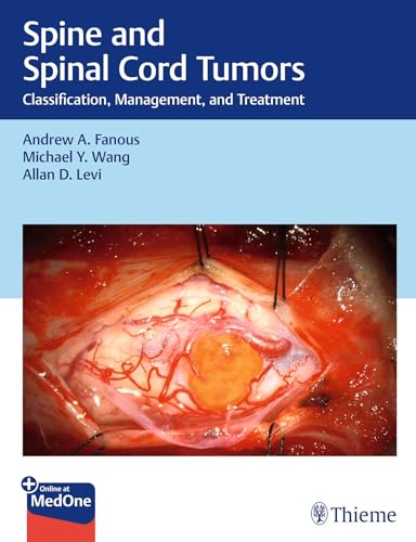 Spine and Spinal Cord Tumors: Classification, Management, and Treatment Spine and Spinal Cord Tumors: Classification, Management, and Treatment von Thieme Publishers New York