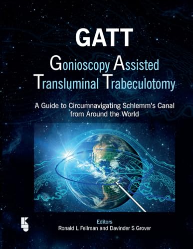 GATT: Gonioscopy Assisted Transluminal Trabeculotomy: A Guide to Circumnavigating Schlemm's Canal from Around the World GATT: Gonioscopy Assisted Transluminal Trabeculotomy: A Guide to Circumnavigating Schlemm's Canal from Around the World von Kugler Publications