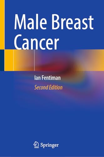 Male Breast Cancer Male Breast Cancer von Springer