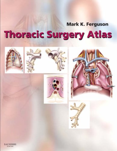 Thoracic Surgery Atlas von Saunders