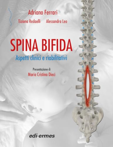 Spina bifida. Aspetti clinici e riabilitativi von Edi. Ermes