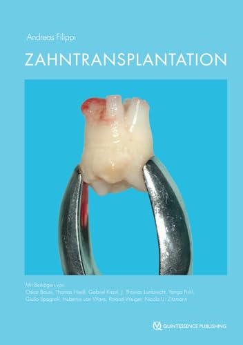Zahntransplantation: Biologischer Zahnersatz für Kinder, Jugendliche und manche Erwachsene Zahntransplantation: Biologischer Zahnersatz für Kinder, Jugendliche und manche Erwachsene