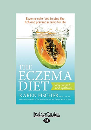 The Eczema Diet Eczema-Safe Food To Stop: Eczema-Safe Food to Stop The Itch and Prevent Eczema for Life: Eczema-Safe Food to Stop the Itch and Prevent Eczema for Life (Large Print 16pt) von ReadHowYouWant