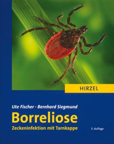 Borreliose: Zeckeninfektion mit Tarnkappe (Ratgeber Gesundheit)