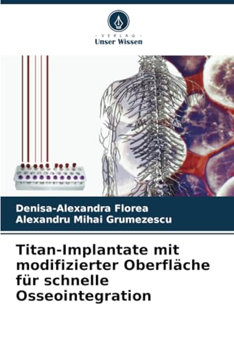 Titan-Implantate mit modifizierter Oberfläche für schnelle Osseointegration: DE von Verlag Unser Wissen