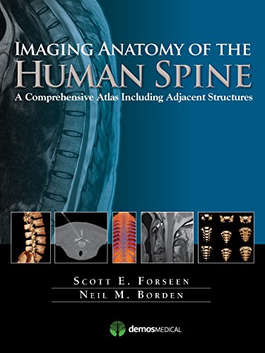 Imaging Anatomy of the Human Spine: A Comprehensive Atlas Including Adjacent Structures