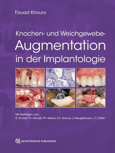 Knochen- und Weichgewebeaugmentation in der Implantologie von Quintessenz Verlag