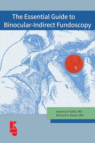 The Essential Guide Plus to Binocular-Indirect Fundoscopy The Essential Guide Plus to Binocular-Indirect Fundoscopy von Kugler Publications