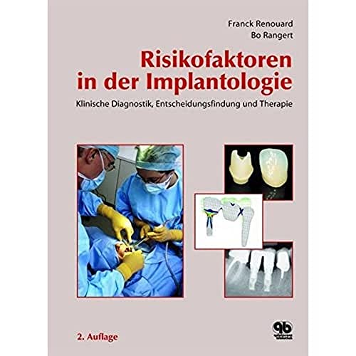 Risikofaktoren in der Implantologie: Klinische Diagnostik, Entscheidungsfindung und Therapie von Quintessenz Verlag