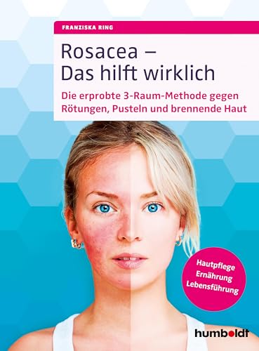 Rosacea - Das hilft wirklich: Die erprobte 3-Raum-Methode gegen Rötungen, Pusteln und brennende Haut, Hautpflege, Ernährung, Lebensführung von Humboldt Verlag