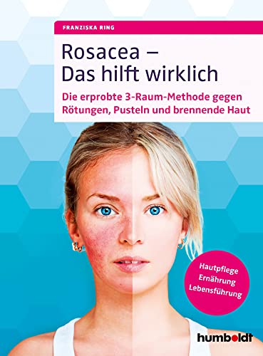 Rosacea - Das hilft wirklich: Die erprobte 3-Raum-Methode gegen Rötungen, Pusteln und brennende Haut, Hautpflege, Ernährung, Lebensführung