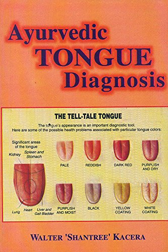 Ayurvedic Tongue Diagnosis