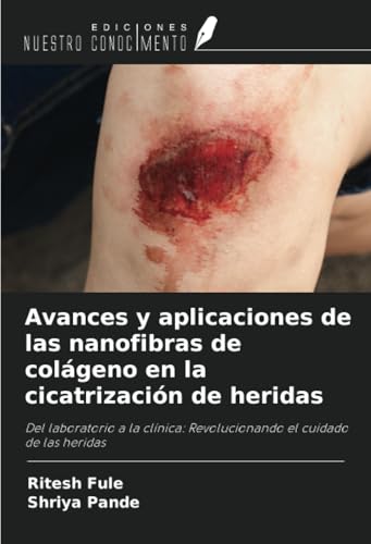 Avances y aplicaciones de las nanofibras de colágeno en la cicatrización de heridas: Del laboratorio a la clínica: Revolucionando el cuidado de las heridas von Ediciones Nuestro Conocimiento