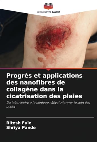 Progrès et applications des nanofibres de collagène dans la cicatrisation des plaies: Du laboratoire à la clinique : Révolutionner le soin des plaies von Editions Notre Savoir