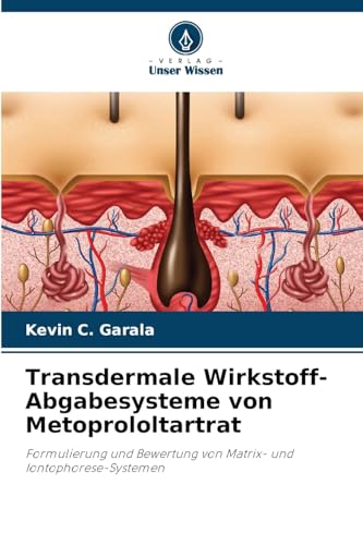 Transdermale Wirkstoff-Abgabesysteme von Metoprololtartrat: Formulierung und Bewertung von Matrix- und Iontophorese-Systemen von Verlag Unser Wissen
