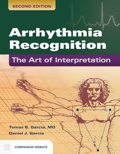 Arrhythmia Recognition: The Art of Interpretation von Jones & Bartlett Publishers