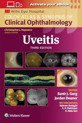 Uveitis: Wills Eye Institute Atlas Series von Lippincott Williams&Wilki