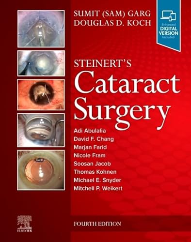 Steinert's Cataract Surgery von Elsevier