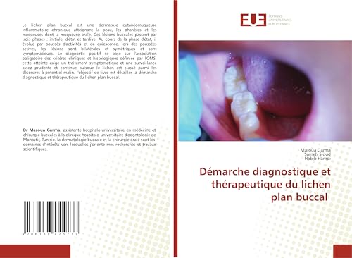 Démarche diagnostique et thérapeutique du lichen plan buccal: DE von Éditions universitaires européennes