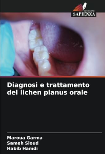 Diagnosi e trattamento del lichen planus orale von Edizioni Sapienza