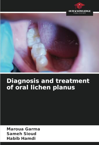 Diagnosis and treatment of oral lichen planus von Our Knowledge Publishing