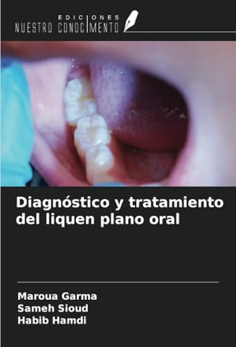 Diagnóstico y tratamiento del liquen plano oral von Ediciones Nuestro Conocimiento