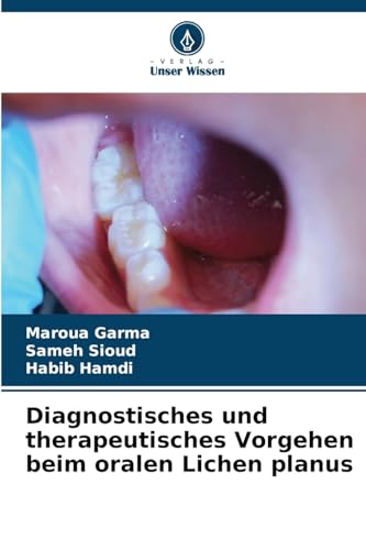 Diagnostisches und therapeutisches Vorgehen beim oralen Lichen planus von Verlag Unser Wissen