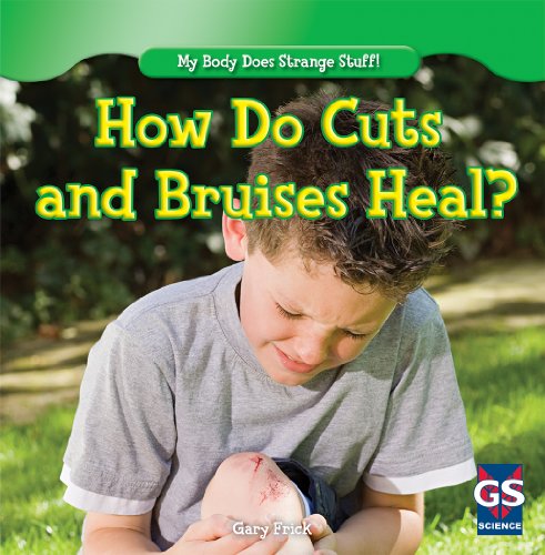 How Do Cuts and Bruises Heal? (My Body Does Strange Stuff!) von Gareth Stevens Publishing