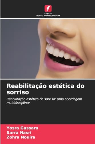 Reabilitação estética do sorriso: Reabilitação estética do sorriso: uma abordagem multidisciplinar von Edições Nosso Conhecimento