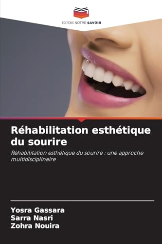 Réhabilitation esthétique du sourire: Réhabilitation esthétique du sourire : une approche multidisciplinaire von Editions Notre Savoir