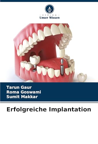 Erfolgreiche Implantation: DE von Verlag Unser Wissen