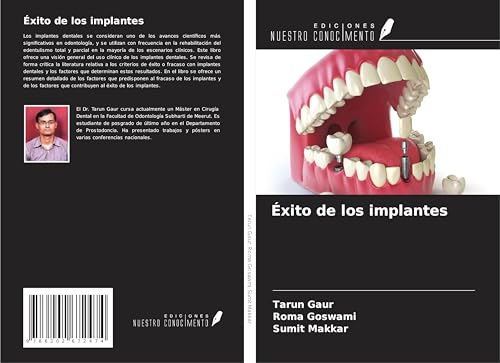 Éxito de los implantes von Ediciones Nuestro Conocimiento