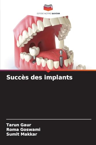 Succès des implants von Editions Notre Savoir