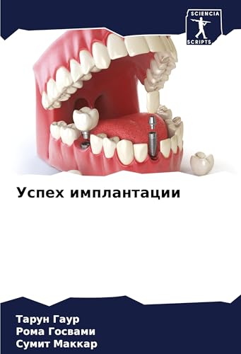 Uspeh implantacii: DE Uspeh implantacii: DE von Sciencia Scripts