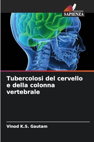 Tubercolosi del cervello e della colonna vertebrale von Edizioni Sapienza