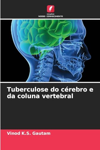 Tuberculose do cérebro e da coluna vertebral: DE von Edições Nosso Conhecimento