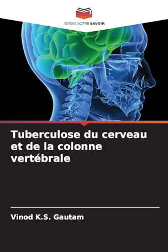 Tuberculose du cerveau et de la colonne vertébrale von Editions Notre Savoir