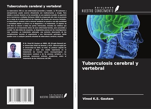 Tuberculosis cerebral y vertebral von Ediciones Nuestro Conocimiento