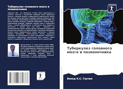 Tuberkulez golownogo mozga i pozwonochnika: DE von Sciencia Scripts
