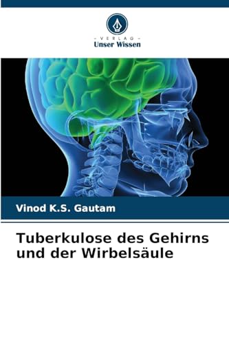 Tuberkulose des Gehirns und der Wirbelsäule von Verlag Unser Wissen