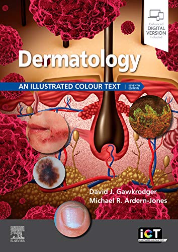 Dermatology: An Illustrated Colour Text von Elsevier