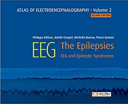 Atlas of Electroencephalography -- Volume 2: The Epilepsies, EEG and Epileptic Syndromes von John Libbey Eurotext