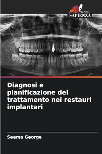 Diagnosi e pianificazione del trattamento nei restauri implantari