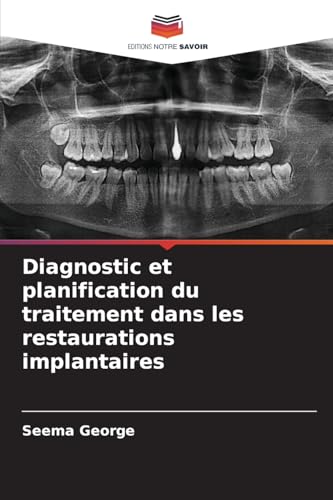 Diagnostic et planification du traitement dans les restaurations implantaires: DE