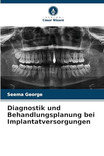 Diagnostik und Behandlungsplanung bei Implantatversorgungen: DE