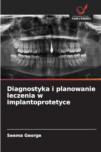 Diagnostyka i planowanie leczenia w implantoprotetyce: DE von Wydawnictwo Nasza Wiedza