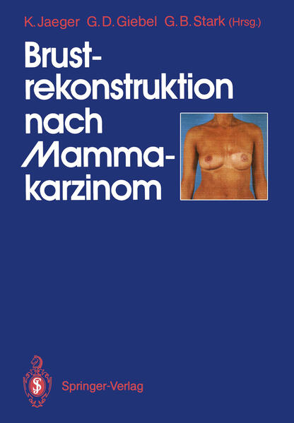 Brustrekonstruktion nach Mammakarzinom von Springer Berlin Heidelberg