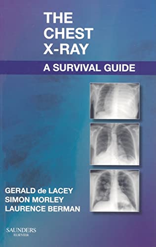 The Chest X-Ray: A Survival Guide von Saunders Ltd.